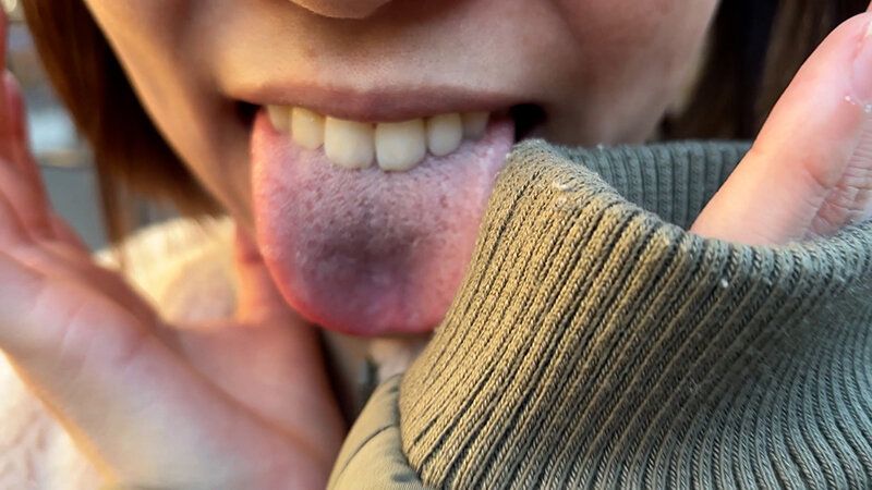 街角で声をかけて口内観察させてもらう オーガニックスーパー勤務 はつみちゃん ギャラリー 5