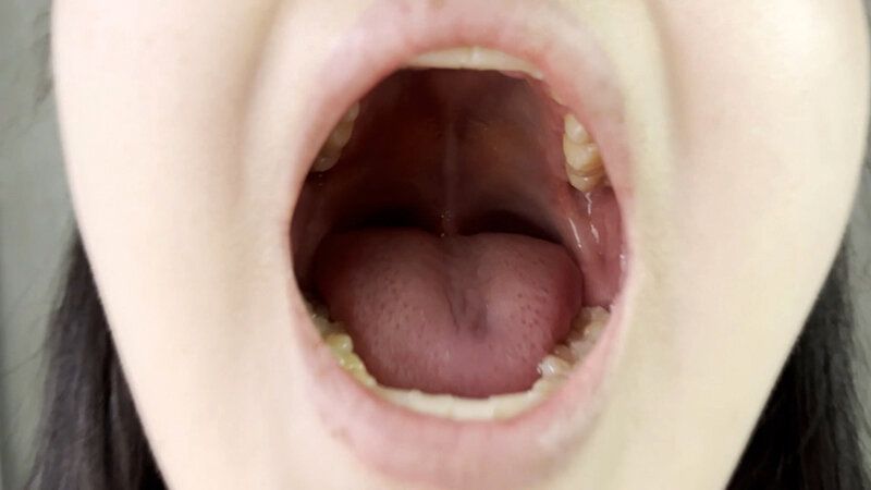 街角で声をかけて口内観察させてもらう 書店員 りかちゃん ギャラリー 5