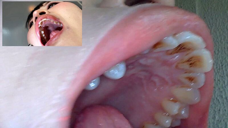 街角で声をかけて口内観察させてもらう コールセンターアルバイト あむちゃん ギャラリー 16