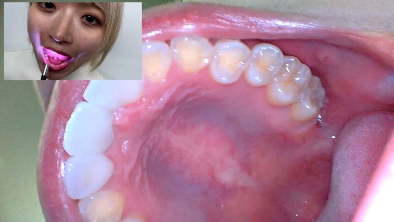 街角で声をかけて口内観察させてもらう 美容部員 はるのちゃん ギャラリー 17