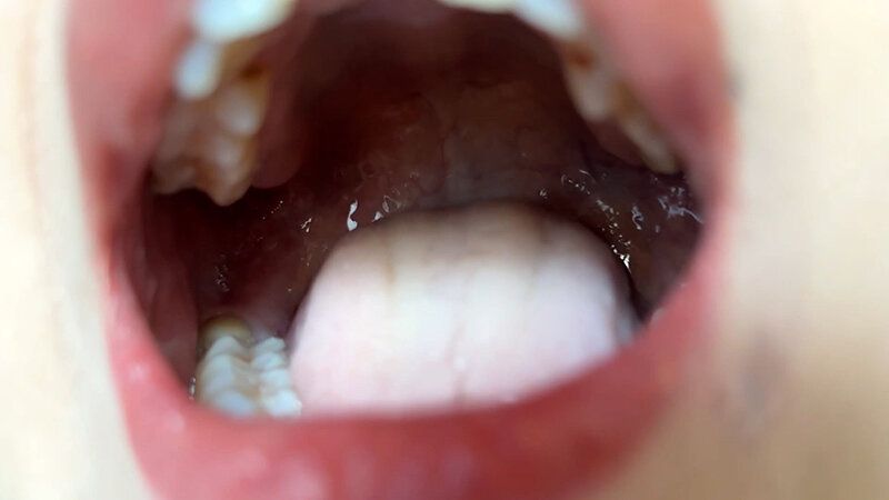 街角で声をかけて口内観察させてもらう コールセンターアルバイト あむちゃん ギャラリー 7