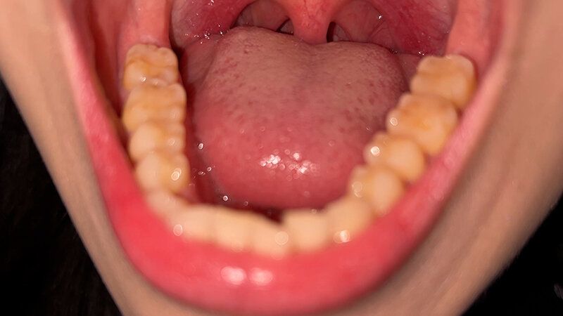 街角で声をかけて口内観察させてもらう スレンダーOL あいちゃん ギャラリー 10