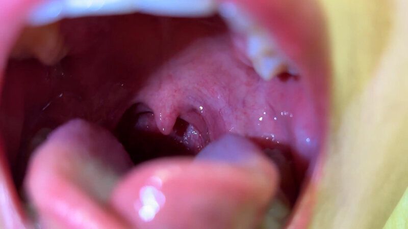 街角で声をかけて口内観察させてもらう 美容部員 はるのちゃん ギャラリー 11