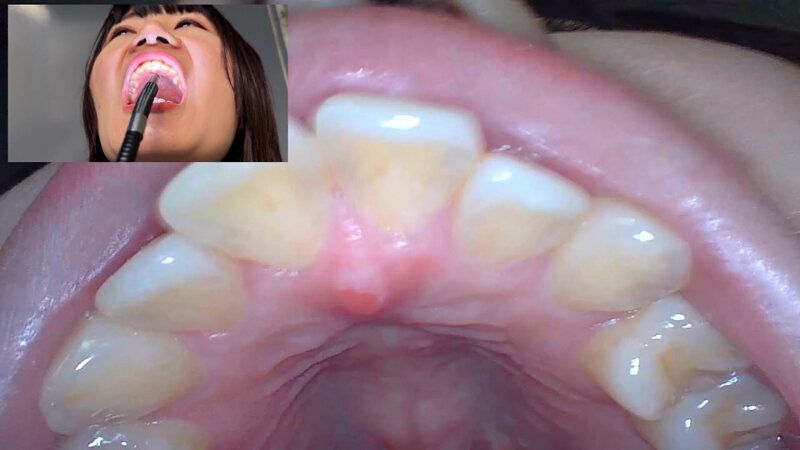 街角で声をかけて口内観察させてもらう 飲食店アルバイト みこちゃん ギャラリー 15