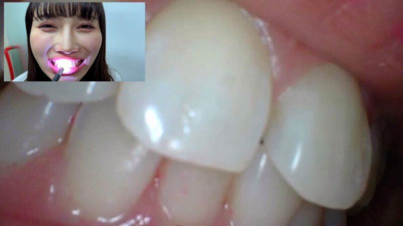 街角で声をかけて口内観察させてもらう アパレル関係 ひなみちゃん ギャラリー 15