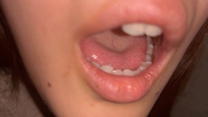 街角で声をかけて口内観察させてもらう 福祉系の専門学生 なぎさちゃん ギャラリー 7