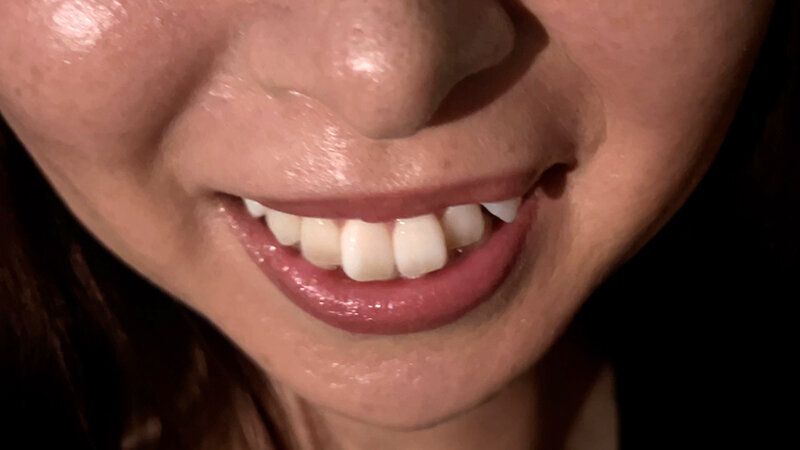 街角で声をかけて口内観察させてもらう 時計屋店員 みらいちゃん ギャラリー 6