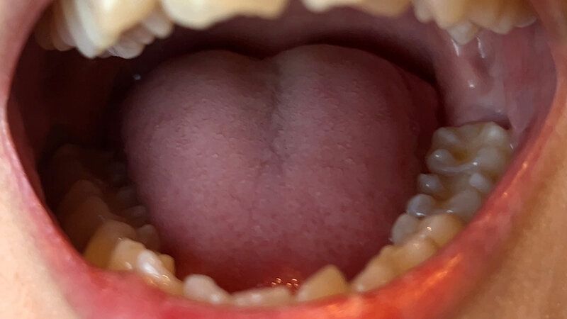 街角で声をかけて口内観察させてもらう カフェ店員 ひなちゃん ギャラリー 4