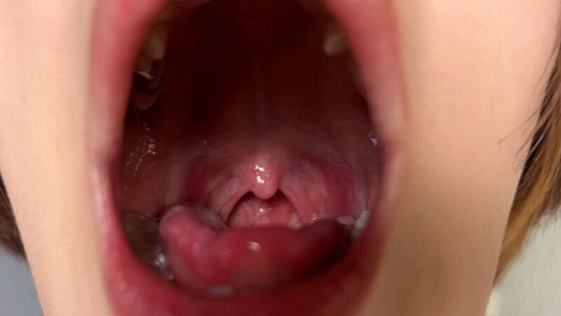 街角で声をかけて口内観察させてもらう パティシエ さらちゃん ギャラリー 7