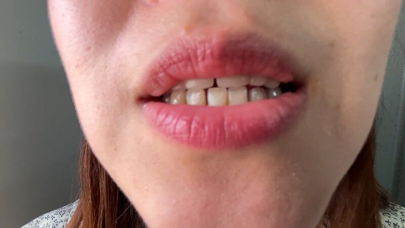 街角で声をかけて口内観察させてもらう ドラッグストア店員 あいるちゃん ギャラリー 4