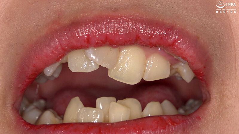 「【歯・口腔フェチ】新人女優相楽さゆなちゃんの口内観察＆巨大女フェチ」わかしラボWAKA-078 相楽さゆな 9 ギャラリー 9