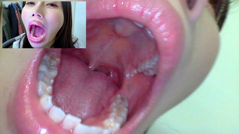 街角で声をかけて口内観察させてもらう アパレル関係 ひなみちゃん ギャラリー 12