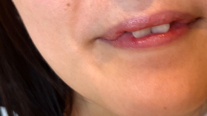 街角で声をかけて口内観察させてもらう カフェ店員 ひなちゃん ギャラリー 13