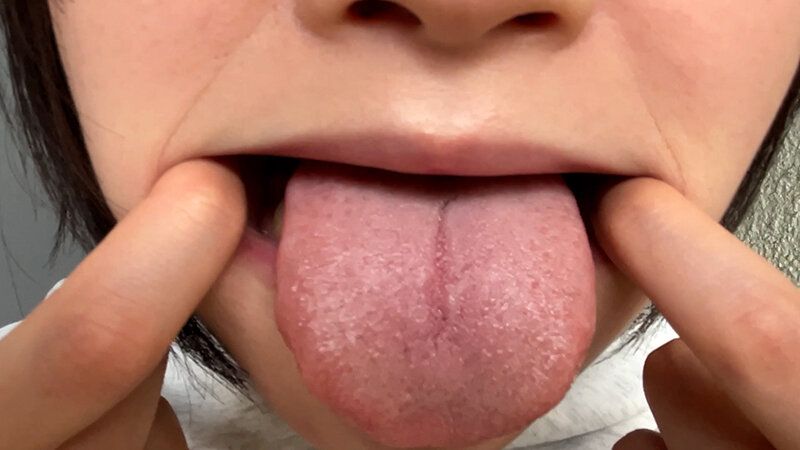 街角で声をかけて口内観察させてもらう 子供英語塾アルバイト のあちゃん ギャラリー 13