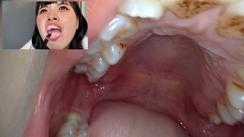 街角で声をかけて口内観察させてもらう コールセンターアルバイト あむちゃん ギャラリー 12