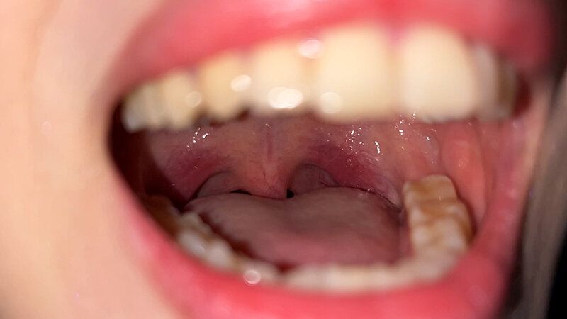 街角で声をかけて口内観察させてもらう スレンダーOL あいちゃん ギャラリー 12