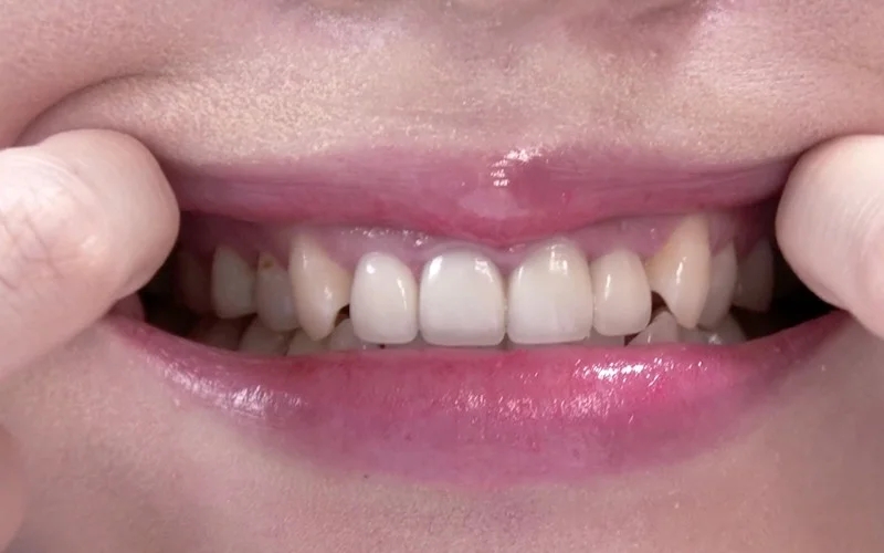 歯フェチ ～じっくり歯観察～ 朝日しずく