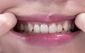 歯フェチ ～じっくり歯観察～ 朝日しずく ギャラリー 6