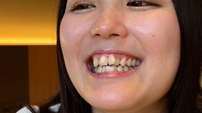 街角で声をかけて口内観察させてもらう カフェ店員 ひなちゃん ギャラリー 20