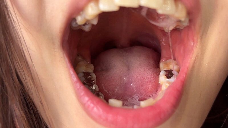 街角で声をかけて口内観察させてもらう アパレル店員 さゆりちゃん ギャラリー 3