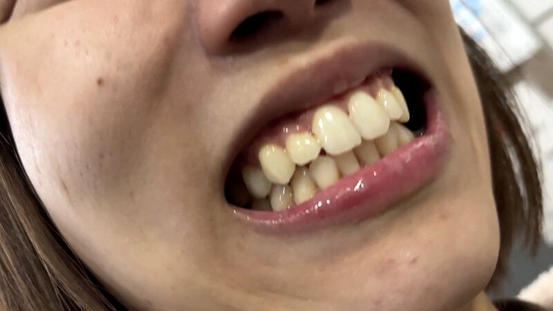 街角で声をかけて口内観察させてもらう オーガニックスーパー勤務 はつみちゃん ギャラリー 18