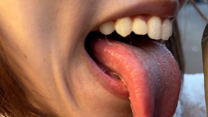 街角で声をかけて口内観察させてもらう オーガニックスーパー勤務 はつみちゃん ギャラリー 7