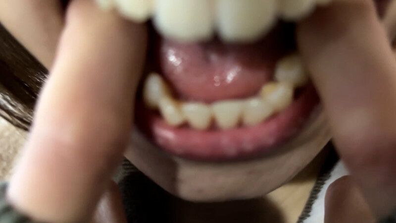 街角で声をかけて口内観察させてもらう オーガニックスーパー勤務 はつみちゃん ギャラリー 14