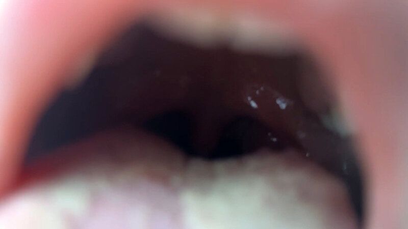 街角で声をかけて口内観察させてもらう 大学生 ゆゆちゃん ギャラリー 11