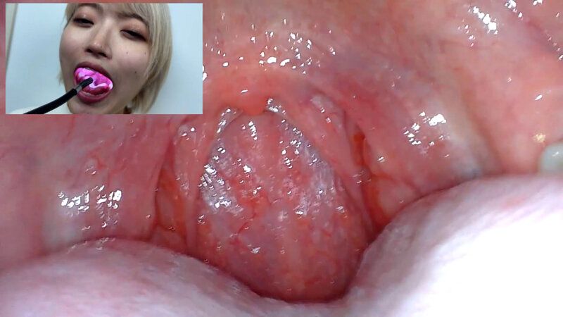 街角で声をかけて口内観察させてもらう 美容部員 はるのちゃん ギャラリー 16