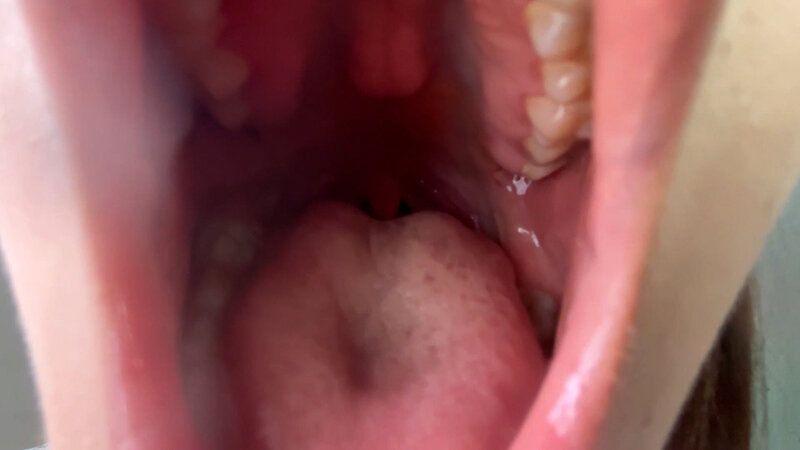 街角で声をかけて口内観察させてもらう ドラッグストア店員 あいるちゃん ギャラリー 10