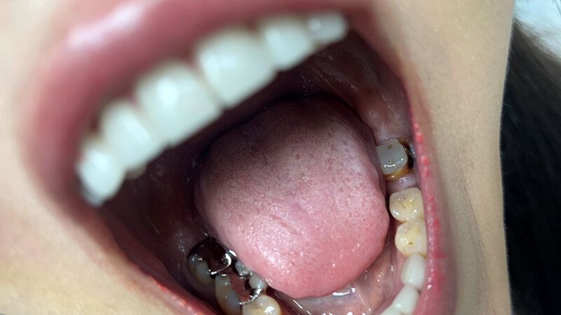 街角で声をかけて口内観察させてもらう エッチで金欠な女の子 ゆりなちゃん ギャラリー 7