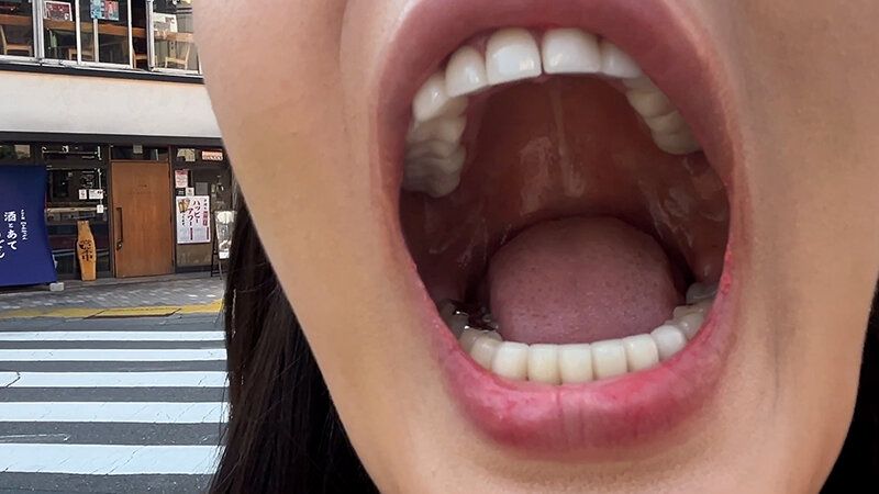 街角で声をかけて口内観察させてもらう エッチで金欠な女の子 ゆりなちゃん ギャラリー 2