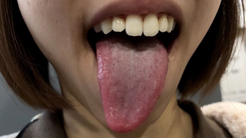 街角で声をかけて口内観察させてもらう オーガニックスーパー勤務 はつみちゃん ギャラリー 16