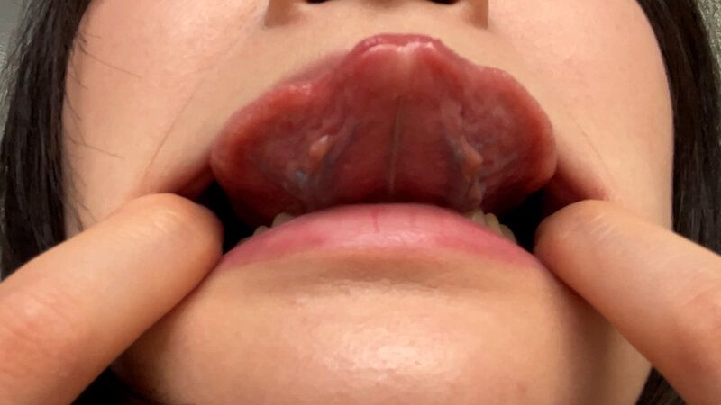 街角で声をかけて口内観察させてもらう 子供英語塾アルバイト のあちゃん ギャラリー 15