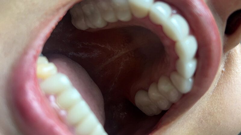 街角で声をかけて口内観察させてもらう エッチで金欠な女の子 ゆりなちゃん ギャラリー 6