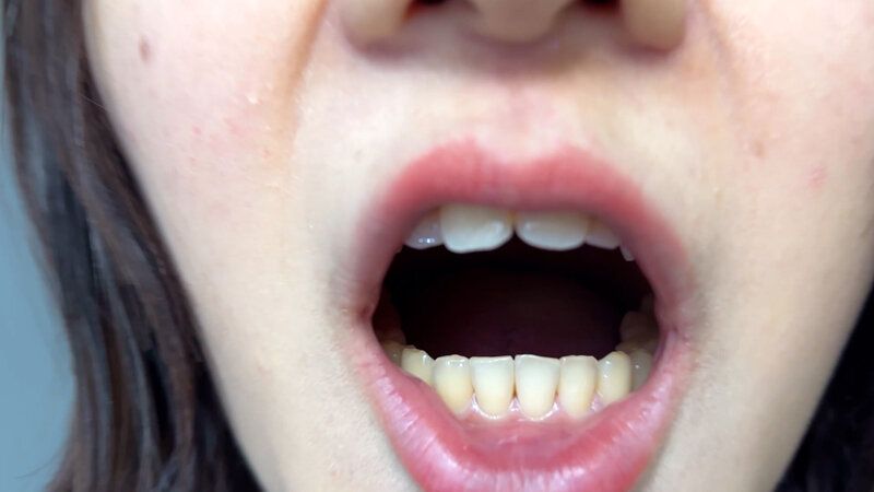 街角で声をかけて口内観察させてもらう 飲食店アルバイト みこちゃん ギャラリー 9