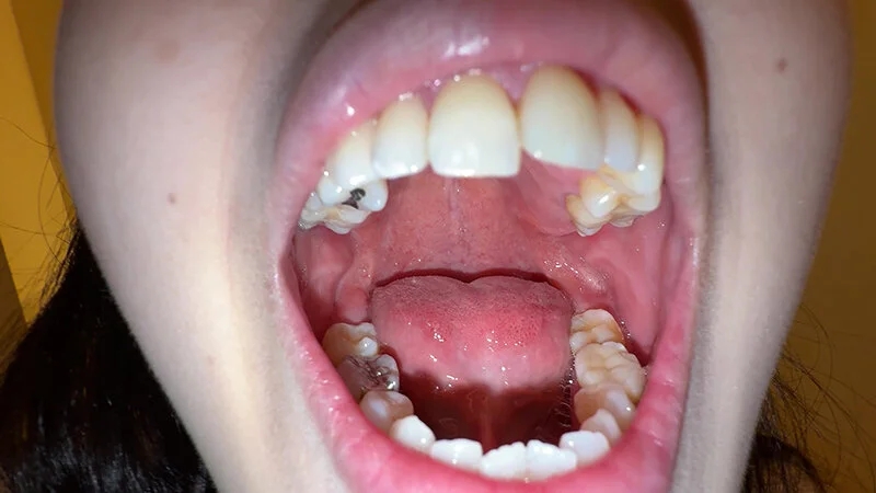 【個人撮影】横山夏希の喉チンコ触り＆肉厚舌を開口器で観察