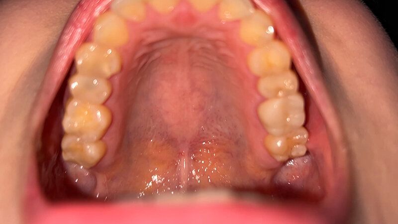 街角で声をかけて口内観察させてもらう スレンダーOL あいちゃん ギャラリー 11