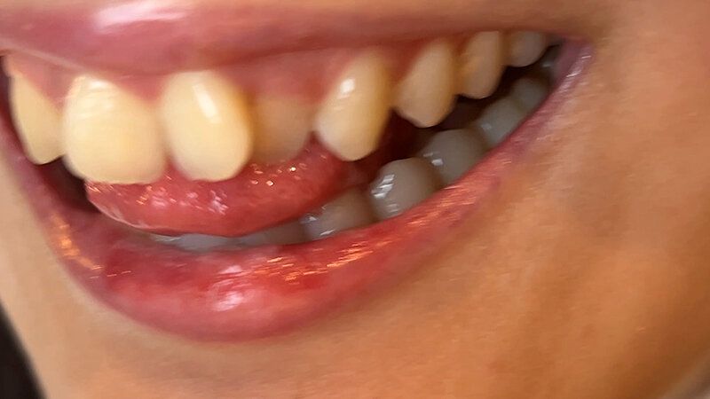 街角で声をかけて口内観察させてもらう カフェ店員 ひなちゃん ギャラリー 11