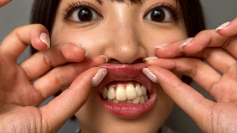 街角で声をかけて口内観察させてもらう パティシエ さらちゃん ギャラリー 10