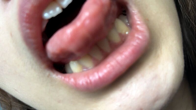 街角で声をかけて口内観察させてもらう 大学生 ゆゆちゃん ギャラリー 12