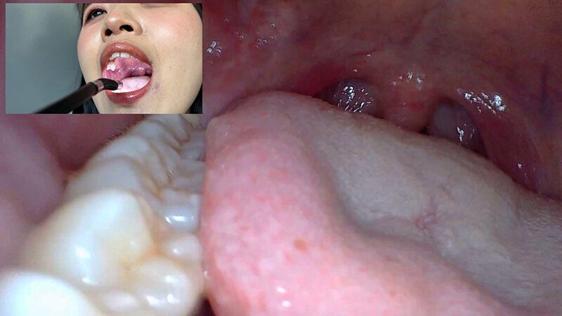 街角で声をかけて口内観察させてもらう コールセンターアルバイト あむちゃん ギャラリー 10