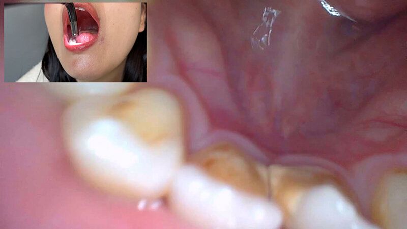 街角で声をかけて口内観察させてもらう コールセンターアルバイト あむちゃん ギャラリー 14