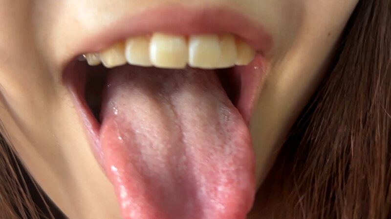 街角で声をかけて口内観察させてもらう アパレル店員 さゆりちゃん ギャラリー 15