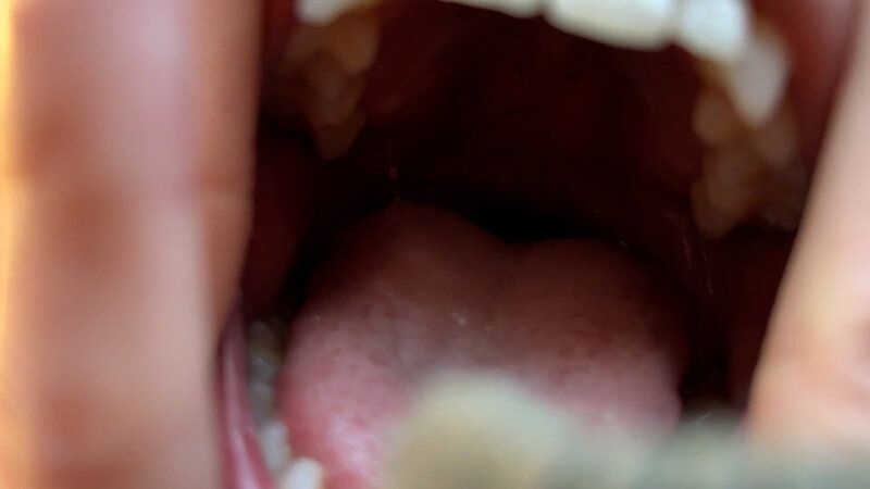 街角で声をかけて口内観察させてもらう オーガニックスーパー勤務 はつみちゃん ギャラリー 4