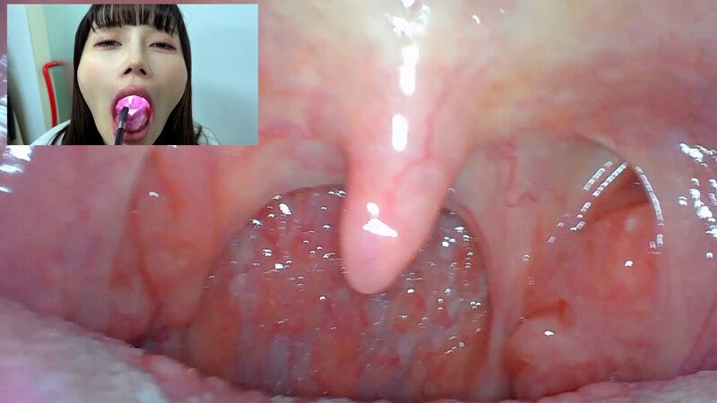 街角で声をかけて口内観察させてもらう アパレル関係 ひなみちゃん ギャラリー 9