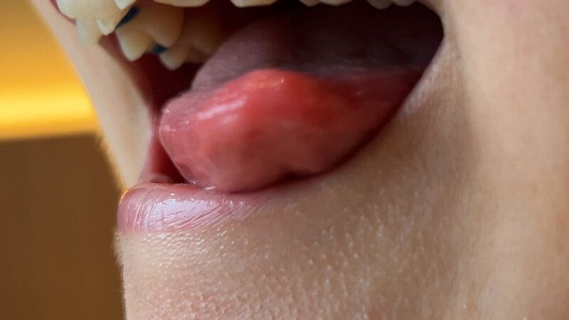 街角で声をかけて口内観察させてもらう カフェ店員 ひなちゃん ギャラリー 6