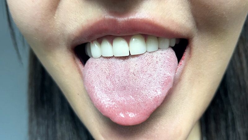 街角で声をかけて口内観察させてもらう エッチで金欠な女の子 ゆりなちゃん ギャラリー 5