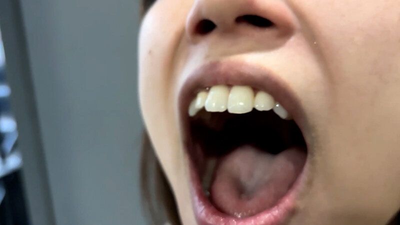 街角で声をかけて口内観察させてもらう オーガニックスーパー勤務 はつみちゃん ギャラリー 10