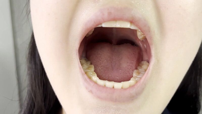 街角で声をかけて口内観察させてもらう 書店員 りかちゃん ギャラリー 15